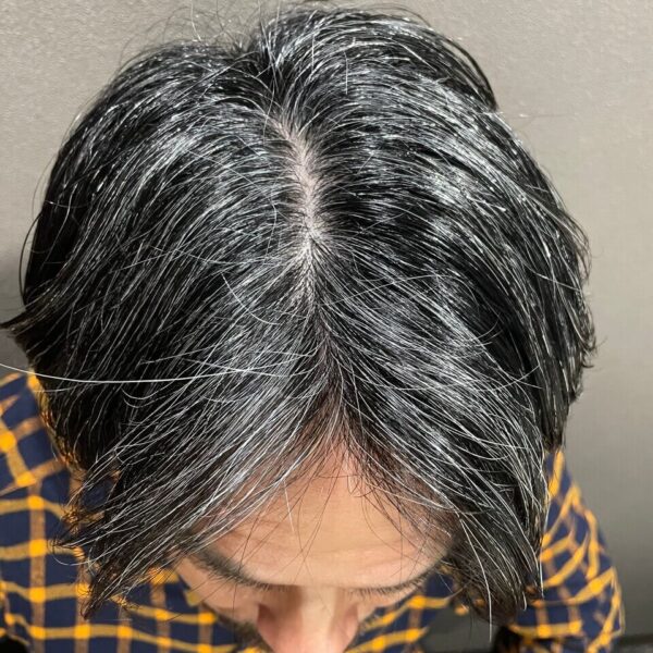 育毛に、白髪におすすめ♪