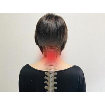 -首からくる頭痛-