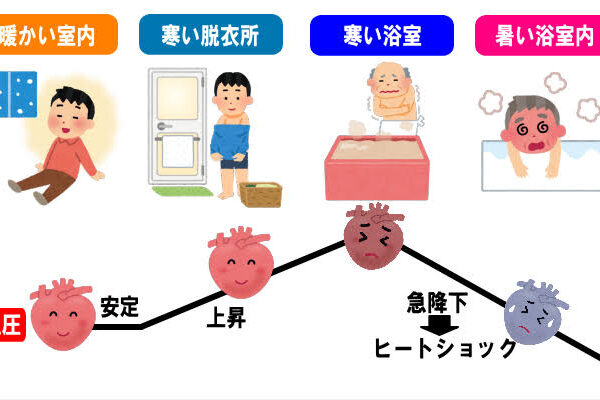 !この時期、警戒すべきヒートショック!